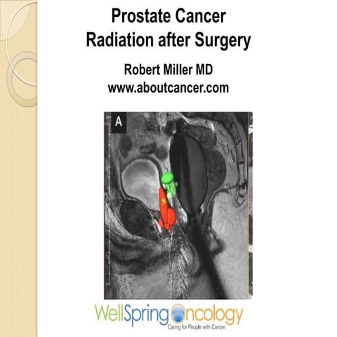 Prostate Cancer and the Role of PostOp Radiation