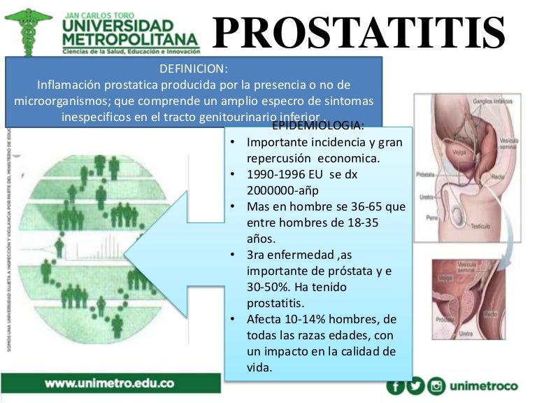 años de prostatitis