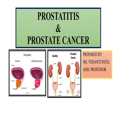 Prostatitis & Prostate Cancer.pptx (Male Reproductive System)