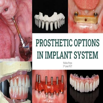 prosthetic options in implant