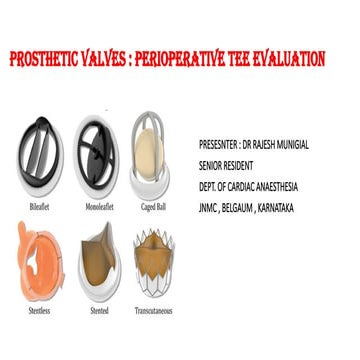 PROSTHETIC VALVES-perioperative echo evaluation.pptx