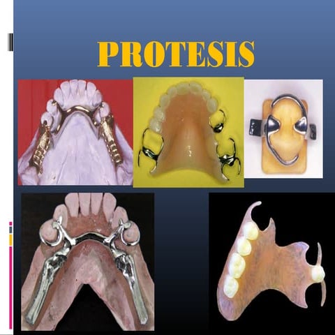 Conectores PPR | PPTX
