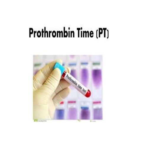 PROTHROMBIN TIME.pptx