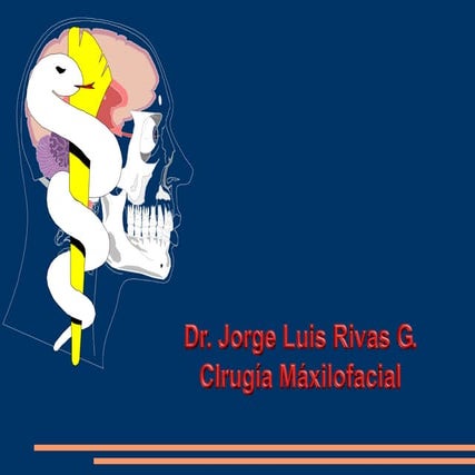 Estereolitografia -Protesis mandibular con implantes pivot