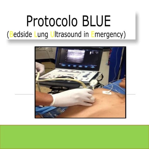 Blue protocolo | PPTX