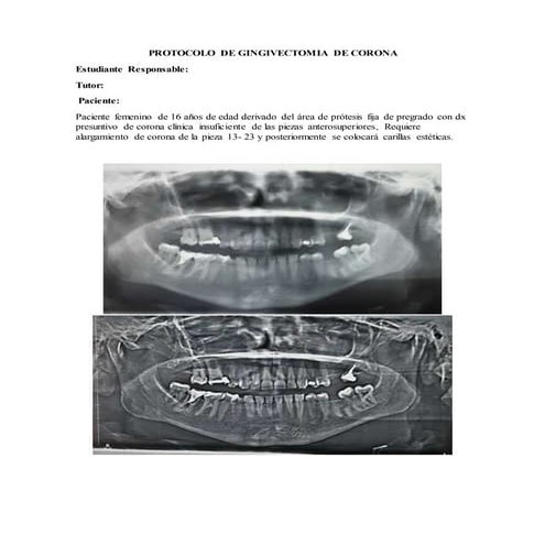 Protocolo diseño de sonrisa