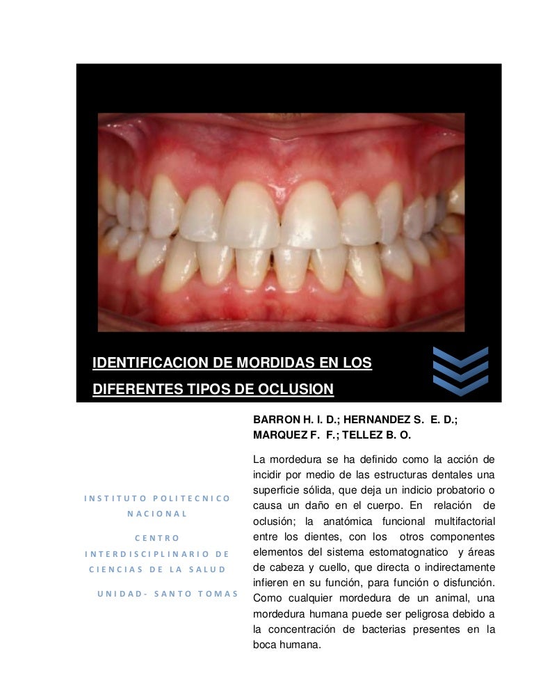 Presión media de una mordida humana