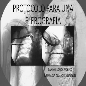 Protocolo para una flebografia