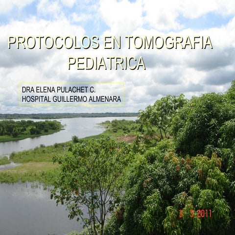 Protocolos en tomografia pediatrica