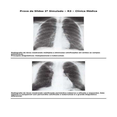 Prova Cirurgia Plástica 