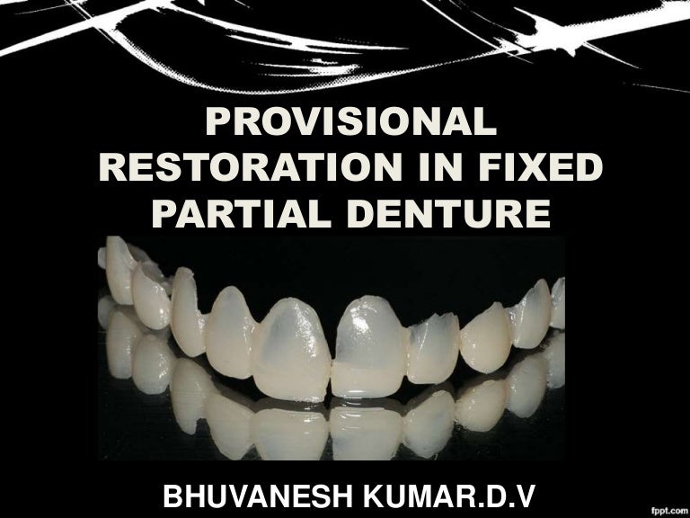 Provisional restoration in fixed partial denture