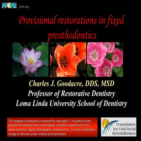 Provisional restorations