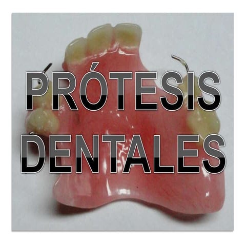 Prótesis dentales