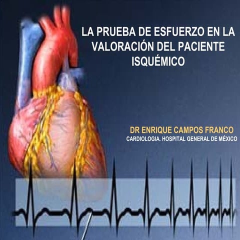 Prueba de Esfuerzo y Cardiopatía Isquémica