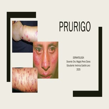 Dermatologia: Prurigo por insectos, nodular y actínico | PPT