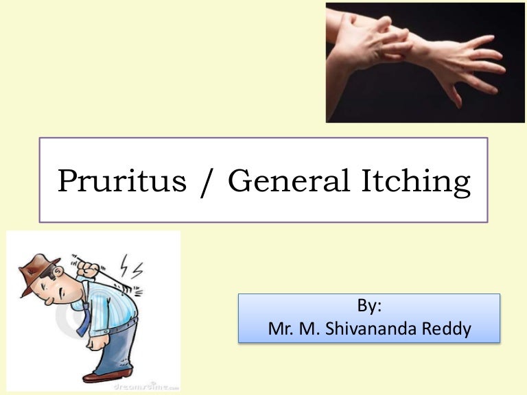 Doxepin and itching