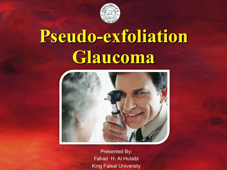 Pseudoexfoliation