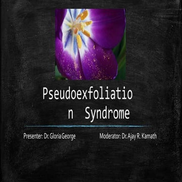 pseudoexfoliationsyndrome-170426175648.pptx