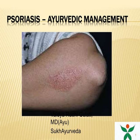 Psoriasis management of ayurveda