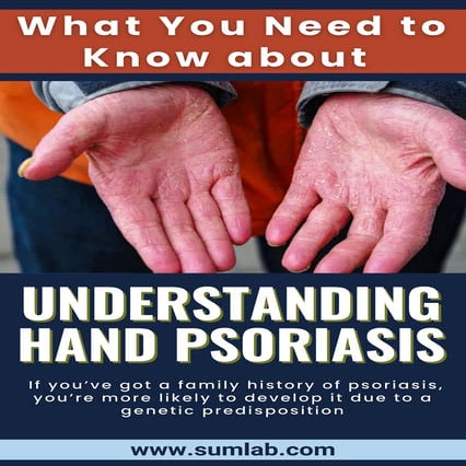 What causes hand psoriasis and can it be prevented? | PDF