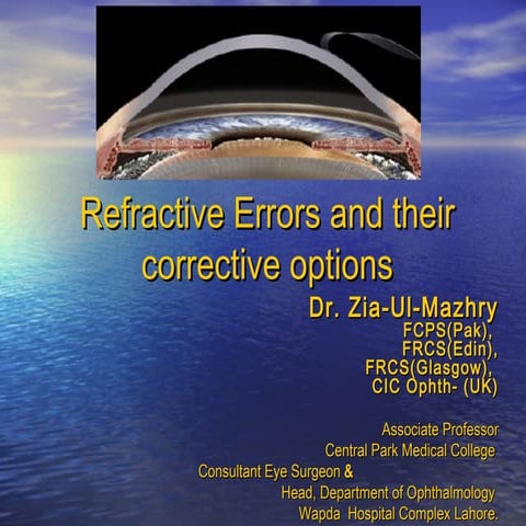 Refractive errors and Refractive Surgery-Basic Concepts