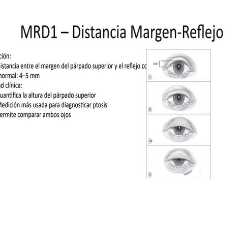 Ecografía ocular modo B longitudinal para evaluación de la mácula | PPTX