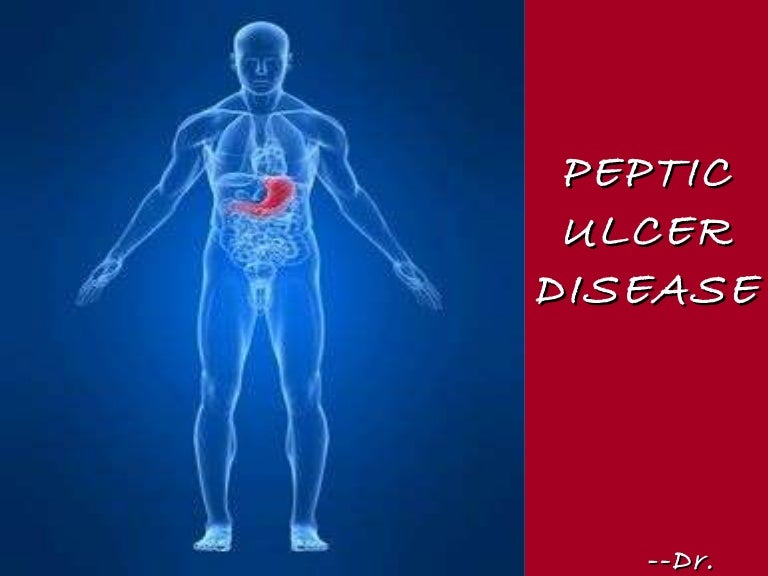 Peptic ulcer disease