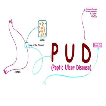 Peptic Ulcer Disease- Pharm-D IV year Therapy