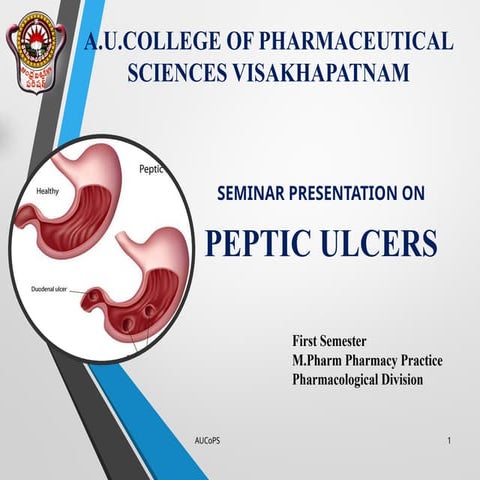 Pharmacotherapy and Pathophysiology of Peptic ulcers