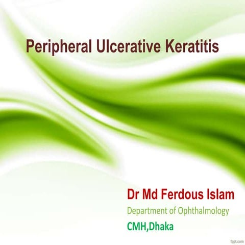 Peripheral Ulcerative Keratitis.Dr Ferdous   