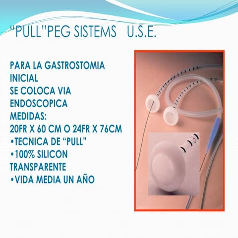 Pull peg sistem | PDF