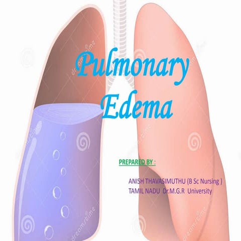 Pulmonary edema