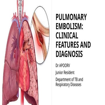 Pulmonary Embolism - (PE) | PPT