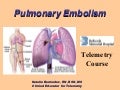 pulmonary embolism define pulmonary embolism