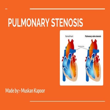 Pulmonary stenosis