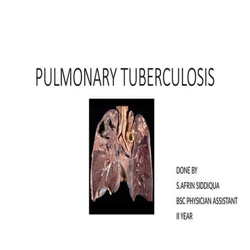 Pediatrics Pulmonary tuberculosis .pptm.pptx