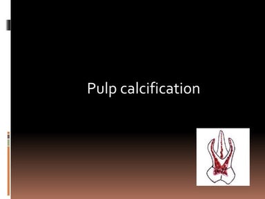 Pulp calcification