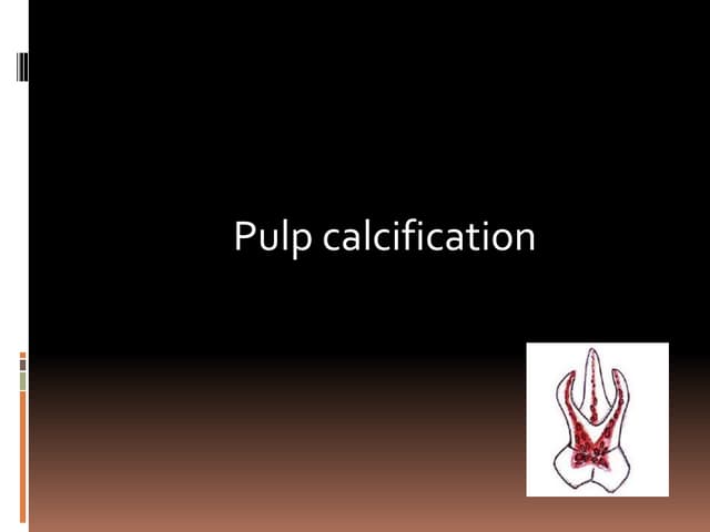 Pulp calcification