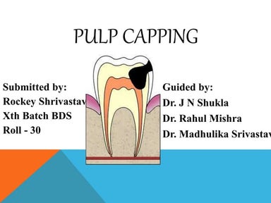 Pulp capping