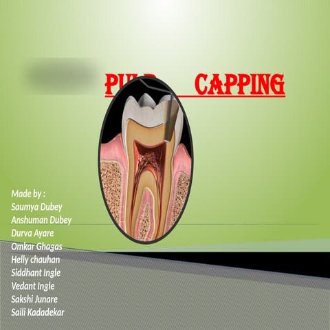 Direct and indirect pulp capping | PPTX