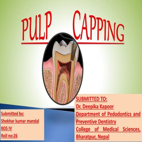 Pulp capping 