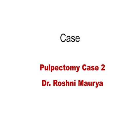 Pulpectomy case 2
