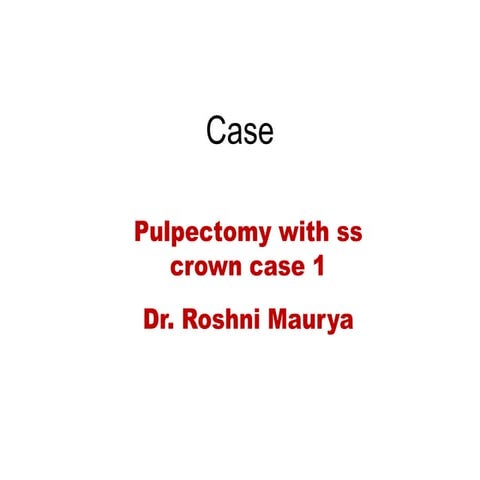 Pulpectomy with ss crown case 1