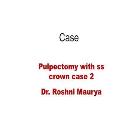 Pulpectomy with ss crown case 2