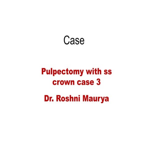 Pulpectomy with ss crown case 3