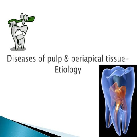 Pulp and periapical  etiology
