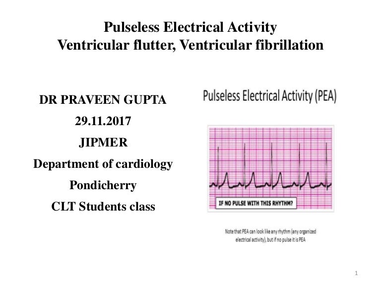 Pulseless Electrical Activity Ventricular Flutter Ventricular Fibri