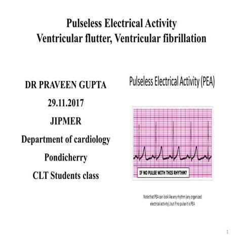 Pulseless electrical activity, Ventricular flutter, Ventricular fibrillation