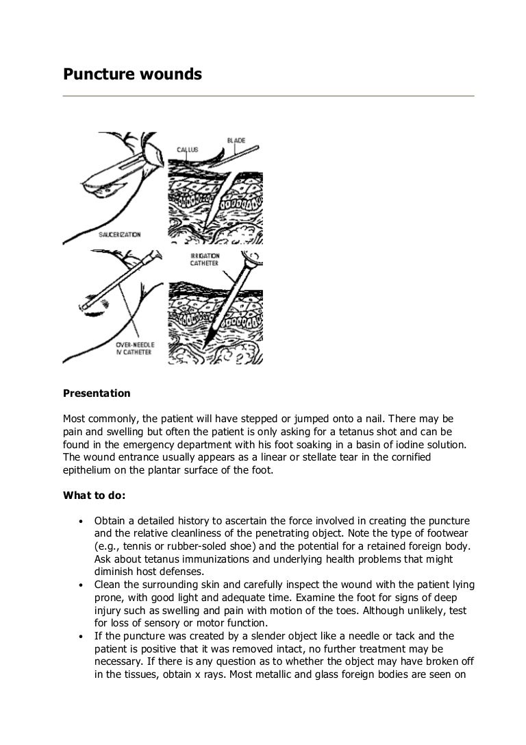 Puncture Wounds