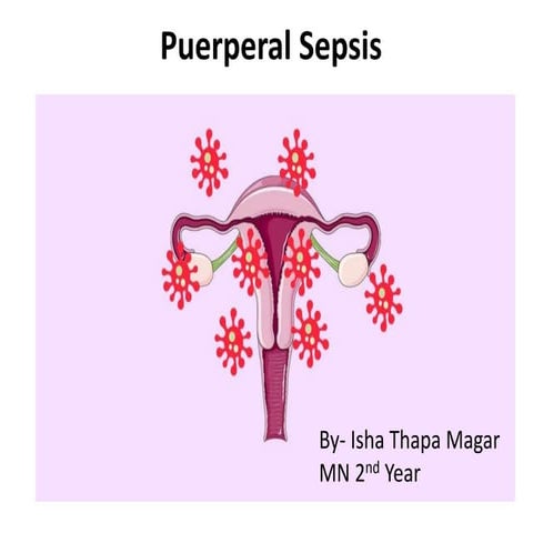 Puperial sepsis